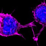 Major grant for research on infectious diseases in Africa