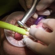 Five Facts About UWC Dentistry That Will Put A Smile On Your Face