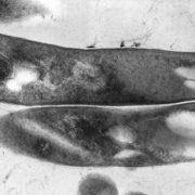 Newly-discovered TB blood signal provides early warning for at-risk patients