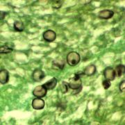 UCT unit tackling fungal infections