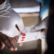 Study find HIV progress in Kwazulu-Natal has stalled